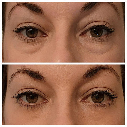Collagen Eye Mask